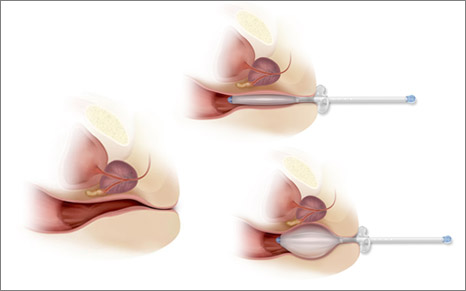 Illustration for QFix Systems